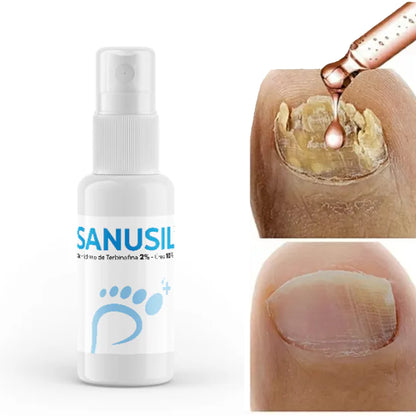 SANUSIL® - SPRAY ANTIHONGOS