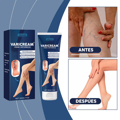 VARICREAM ®